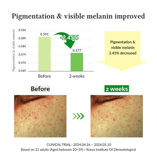 Dr. Althea Gentle Vitamin C Serum 30 ML
