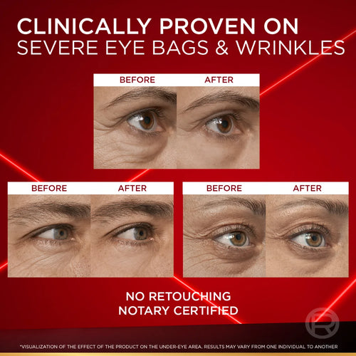 L'Oréal Paris Revitalift Laser Eye Bag Instant Eraser