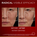 L'Oréal Paris Revitalift Laser Triple Power Serum 30 mL