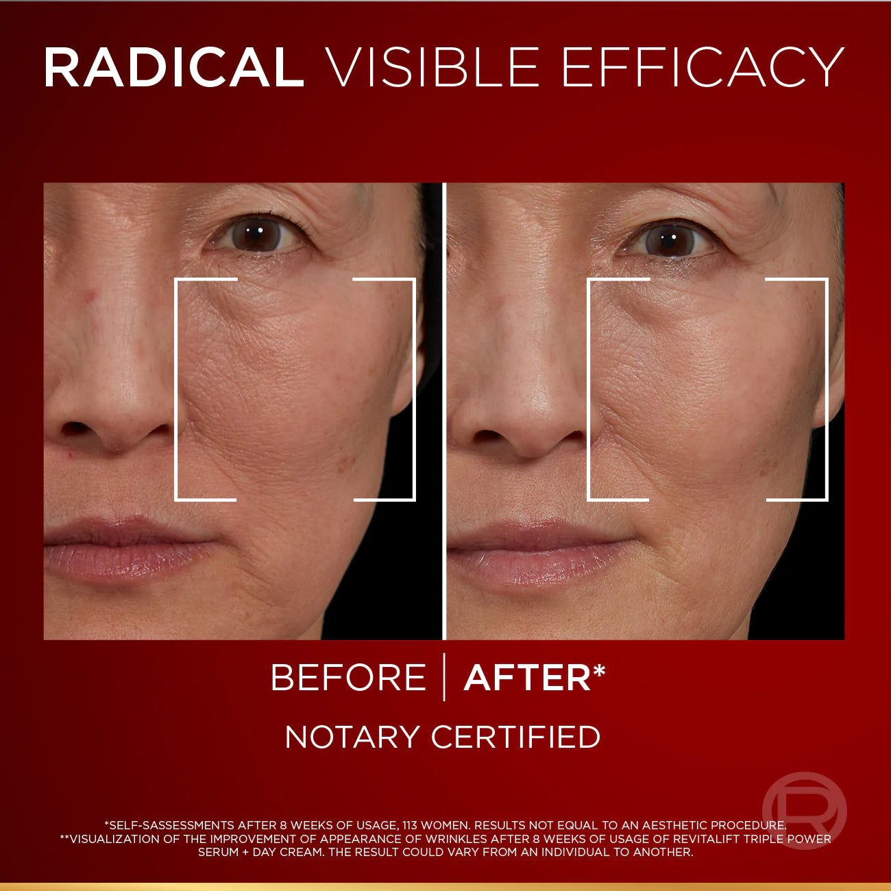 L'Oréal Paris Revitalift Laser Triple Power Serum 30 mL