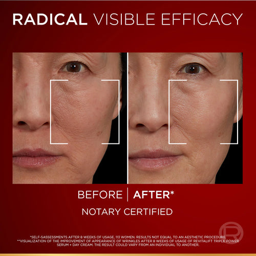 L'Oréal Paris Revitalift Laser Triple Power Serum 30 mL