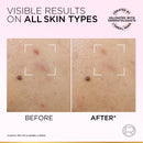 L’Oréal Paris Glycolic Bright Anti-Dark Spot Exfoliant Peel