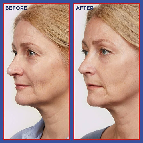 L'Oréal Paris Revitalift Laser Pure Retinol Serum