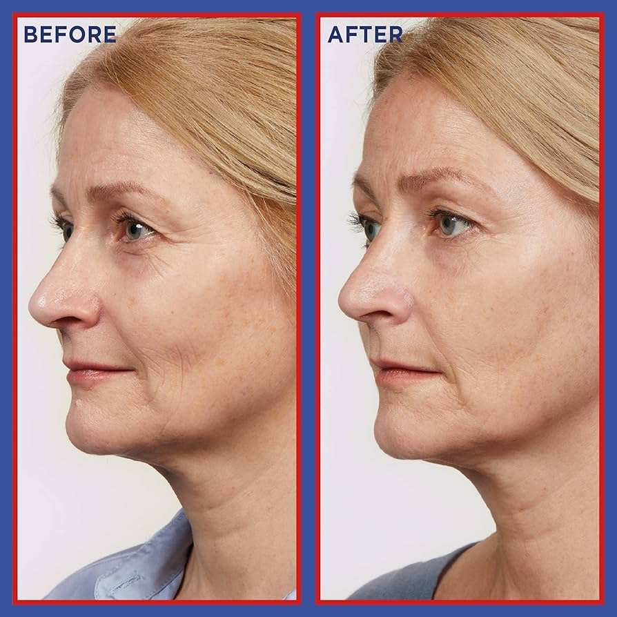 L'Oréal Paris Revitalift Laser Pure Retinol Serum
