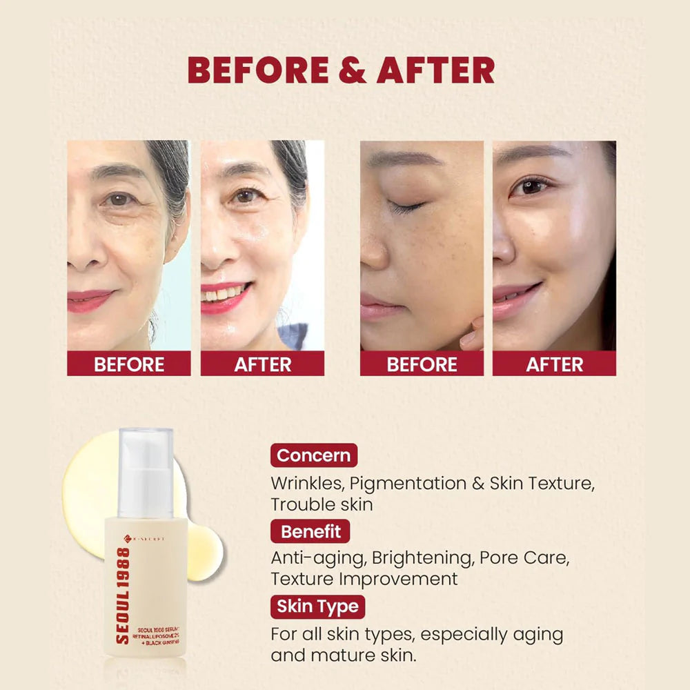KSecret  SEOUL 1988 SERUM : RETINAL LIPOSOME 2% + BLACK GINSENG 30 ML