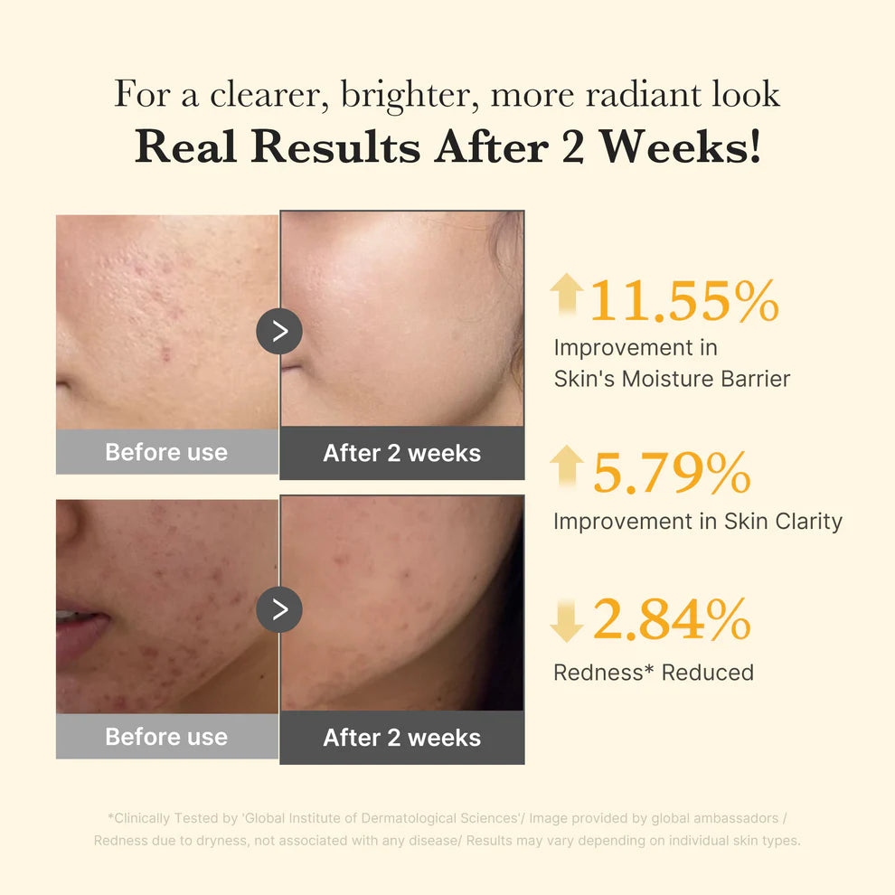 Medicube Kojic Acid Turmeric Niacinamide Serum