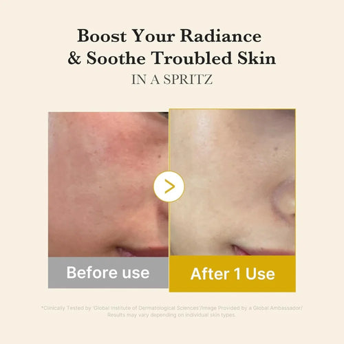 MEDICUBE Kojic  Acid Tumeric Vita Jelly Mist Serum