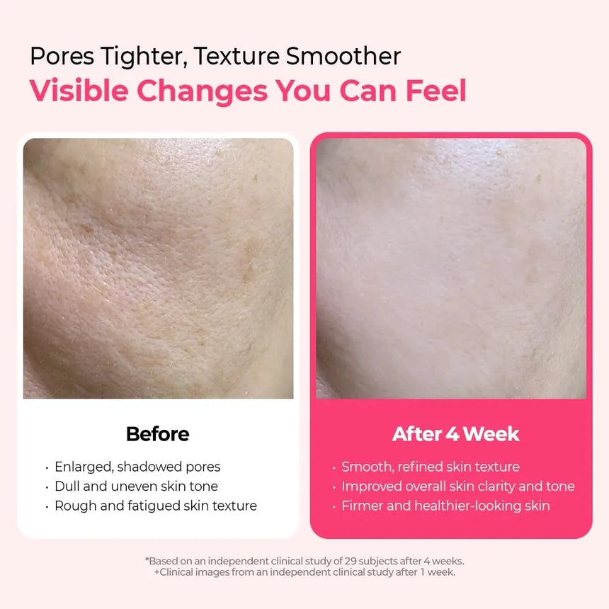 Dr.Melaxin - Cemenrete Cyano Pink Spicule Serum 30ml