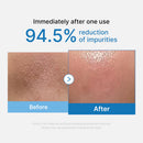 Medicube Zero Pore Cleansing Oil 205ml