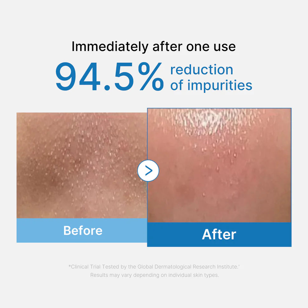Medicube Zero Pore Cleansing Oil 205ml