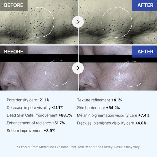 Medicube Zero Exosome Shot 2,000 PPM Spicule Facial Serum