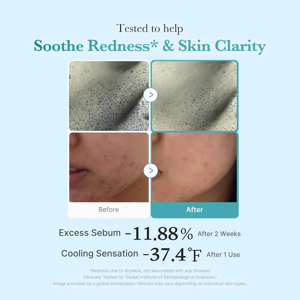 Medicube Azelaic Acid Niacinamide Clarifying Toner