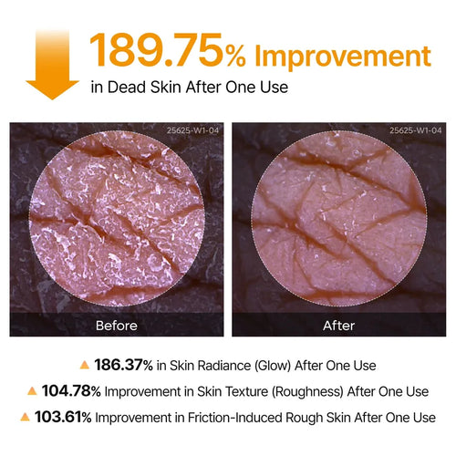 Dr.Melaxin - Peel Shot Exfoliating Kojic Acid Turmeric Spray