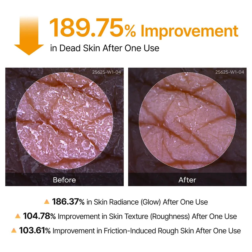 Dr.Melaxin - Peel Shot Exfoliating Kojic Acid Turmeric Spray