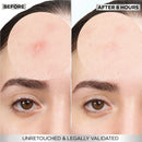 Garnier 8hrs pimple patch