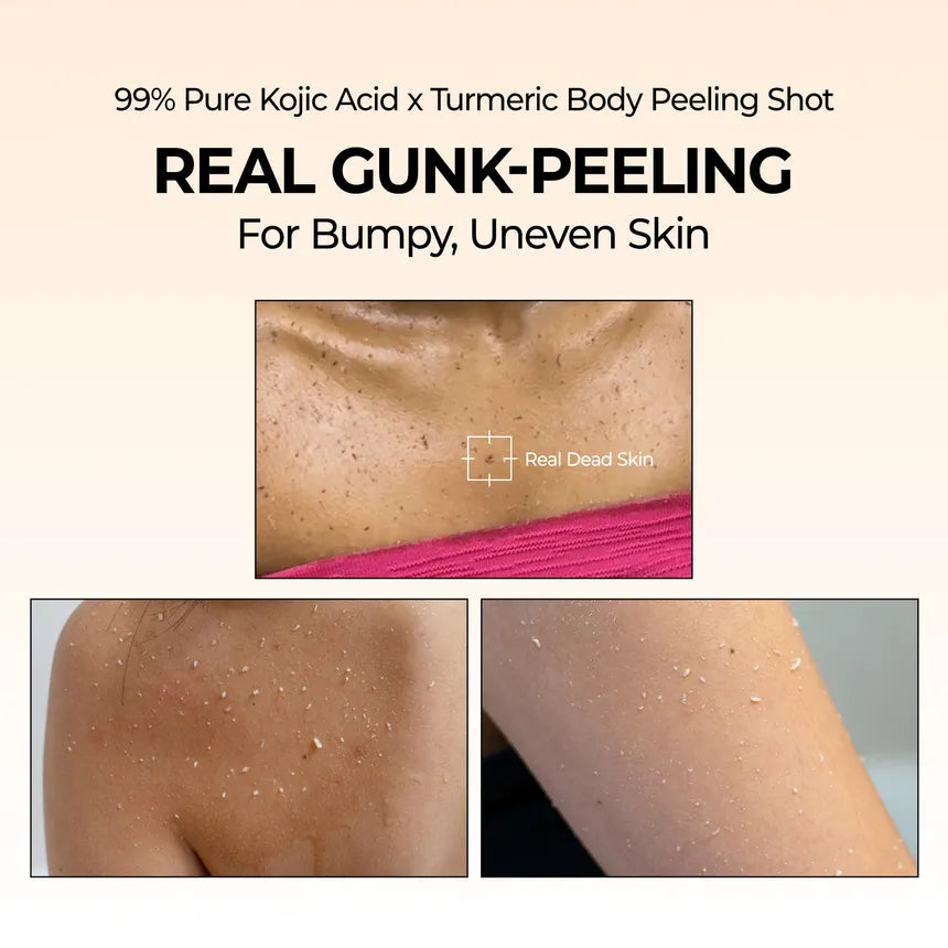 Dr.Melaxin - Peel Shot Exfoliating Kojic Acid Turmeric Spray