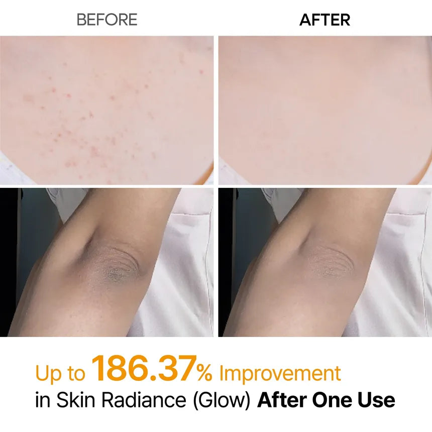 Dr.Melaxin - Peel Shot Exfoliating Kojic Acid Turmeric Spray