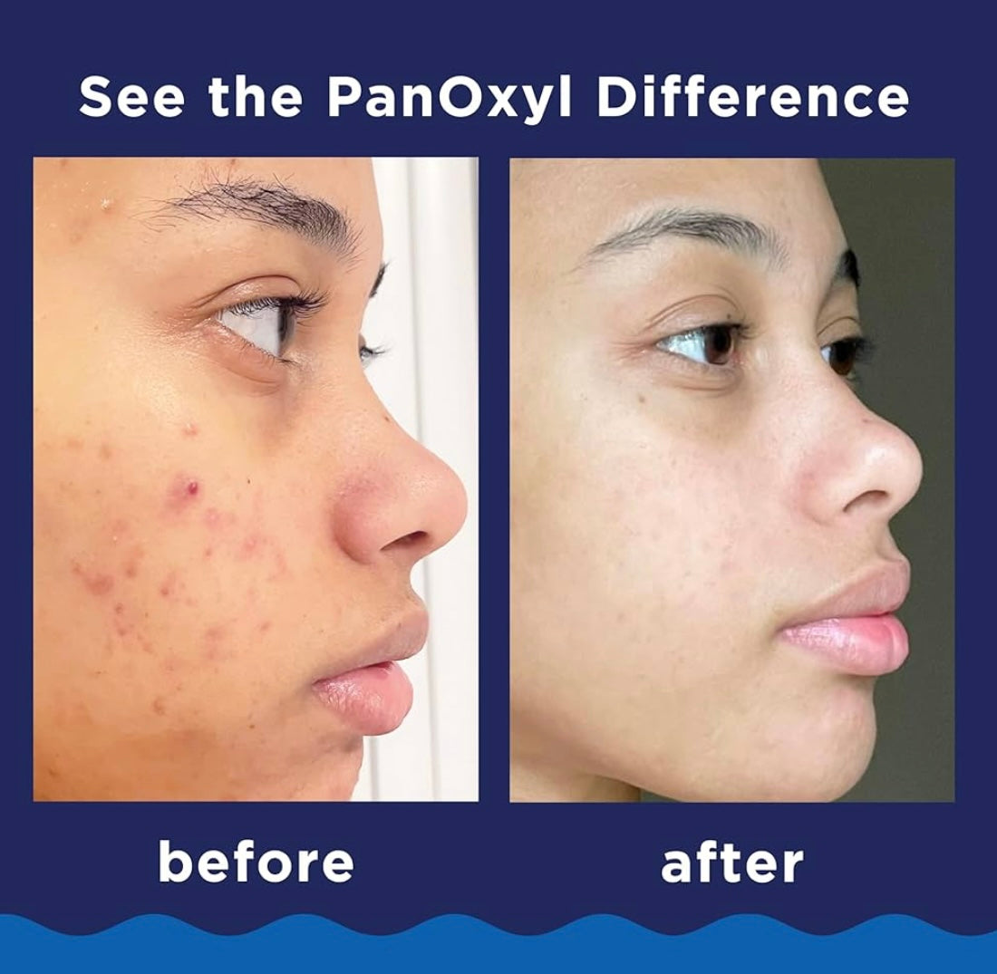 PanOxyl Acne creamy Wash 4 %