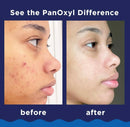 PanOxyl Acne creamy Wash 4 %