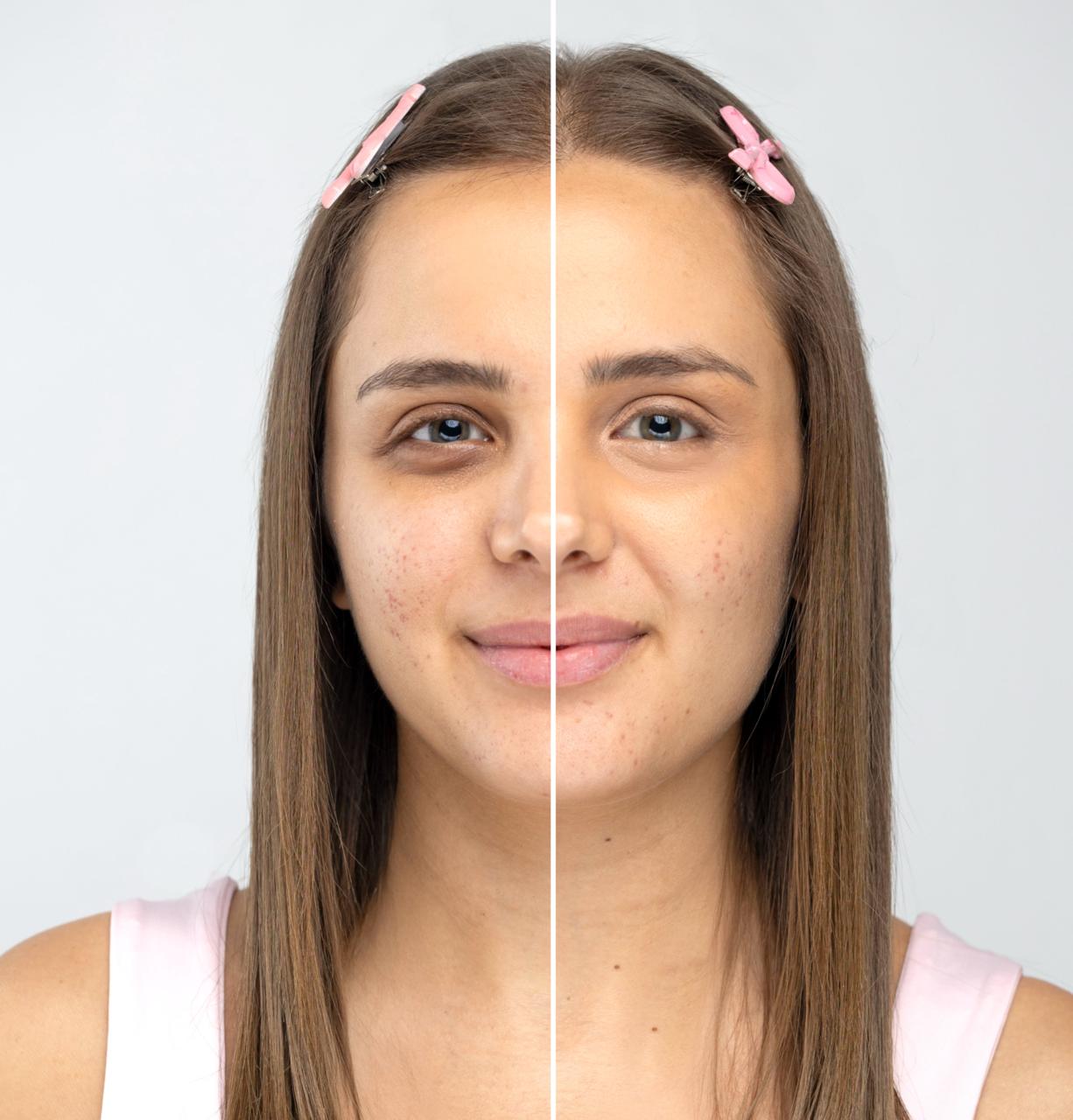 Rosy The Panda Corrector